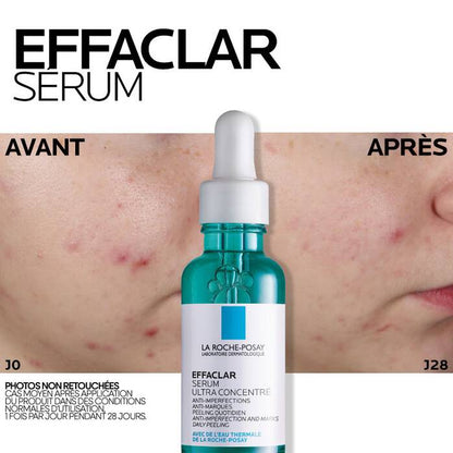 LA ROCHE-POSAY EFFACLAR SÉRUM À L’ACIDE SALICYLIQUE ULTRA CONCENTRÉ - 30 ML