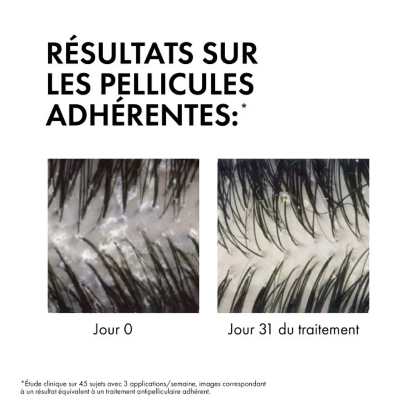 DERCOS SHAMPOOING ÉCO-RECHARGE ANTI-PELLICULAIRE DS CHEVEUX SECS - 390 ML