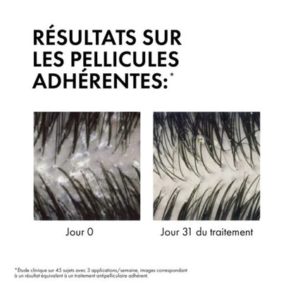 DERCOS SHAMPOOING ÉCO-RECHARGE ANTI-PELLICULAIRE DS CHEVEUX SECS - 390 ML