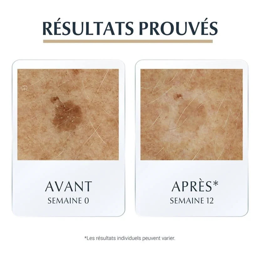 EUCERIN HYALURON-FILLER + ELASTICITY SÉRUM 3D - 30 ML