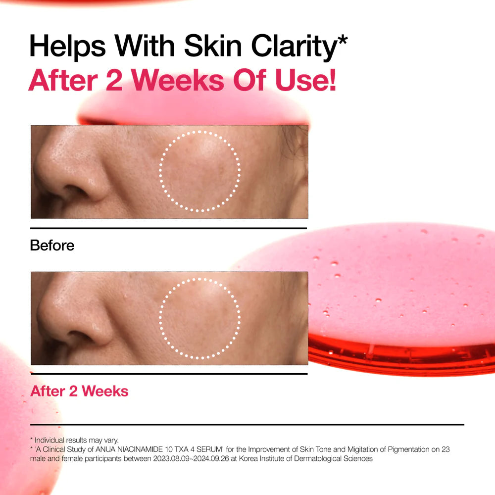 ANUA NIACINAMIDE 10% + TXA 4% SÉRUM ANTI-TACHES & ÉCLAT – 30 ML