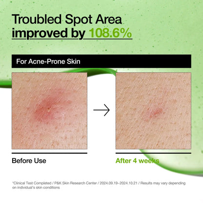 ANUA AZELAIC ACID 10+ HYALURON REDNESS SOOTHING SERUM - 30 ML