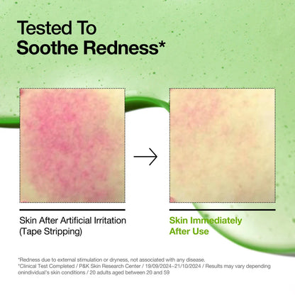 ANUA AZELAIC ACID 10+ HYALURON REDNESS SOOTHING SERUM - 30 ML