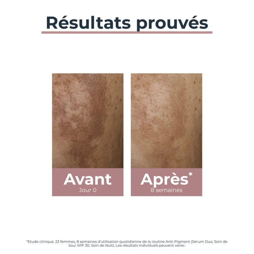 EUCERIN ANTI-PIGMENT SÉRUM DUO - 30 ML