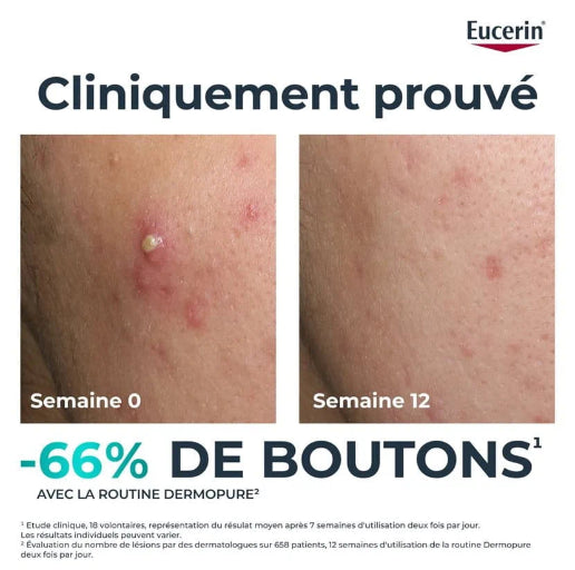 EUCERIN DERMOPURE TRIPLE ACTION SÉRUM - 40 ML
